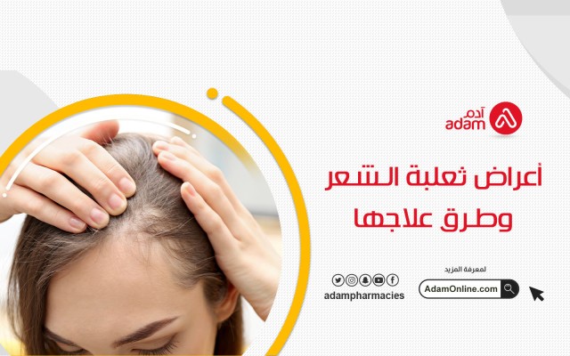 أعراض ثعلبة الشعر وطرق علاجها